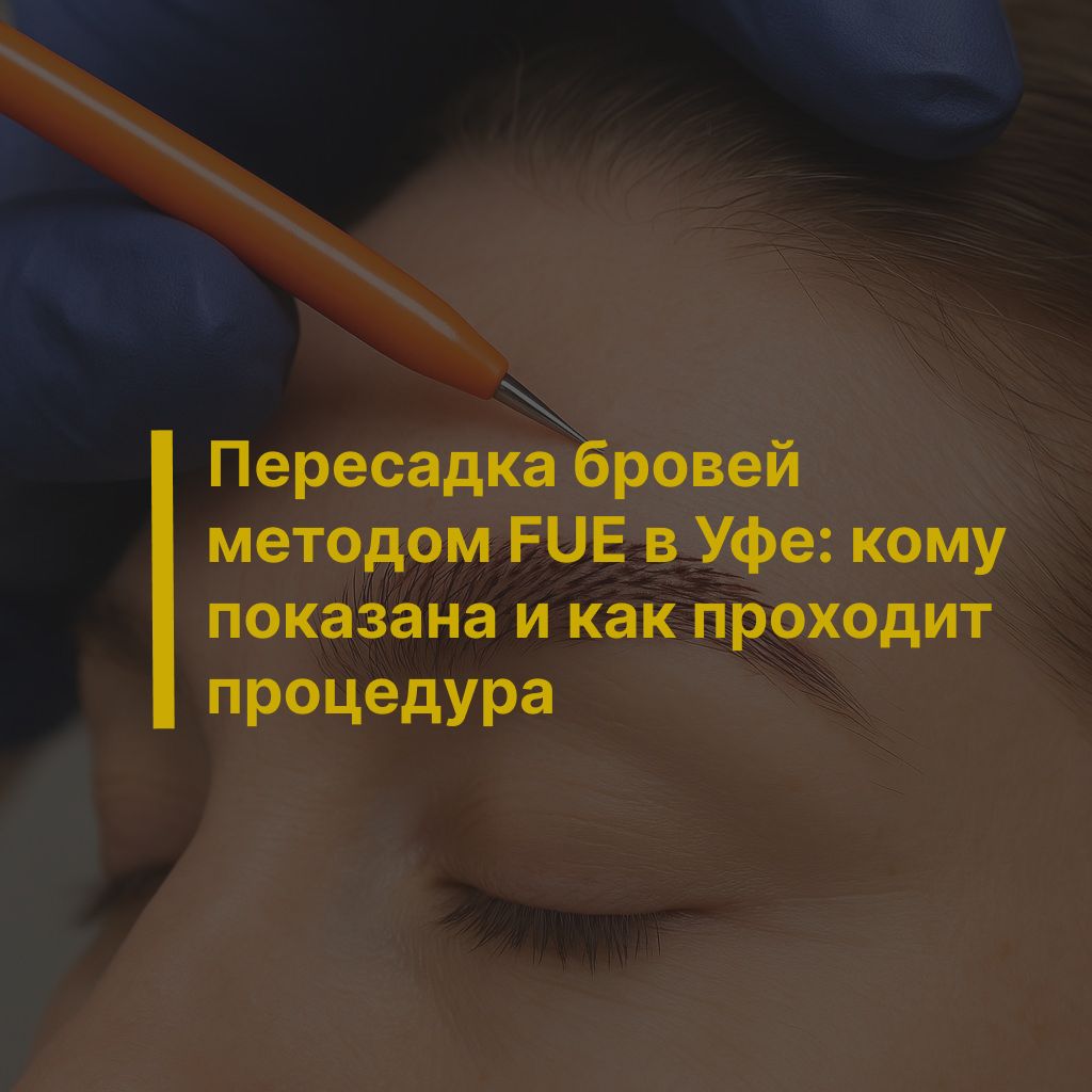 Пересадка бровей методом FUE в Уфе: кому показана и как проходит процедура